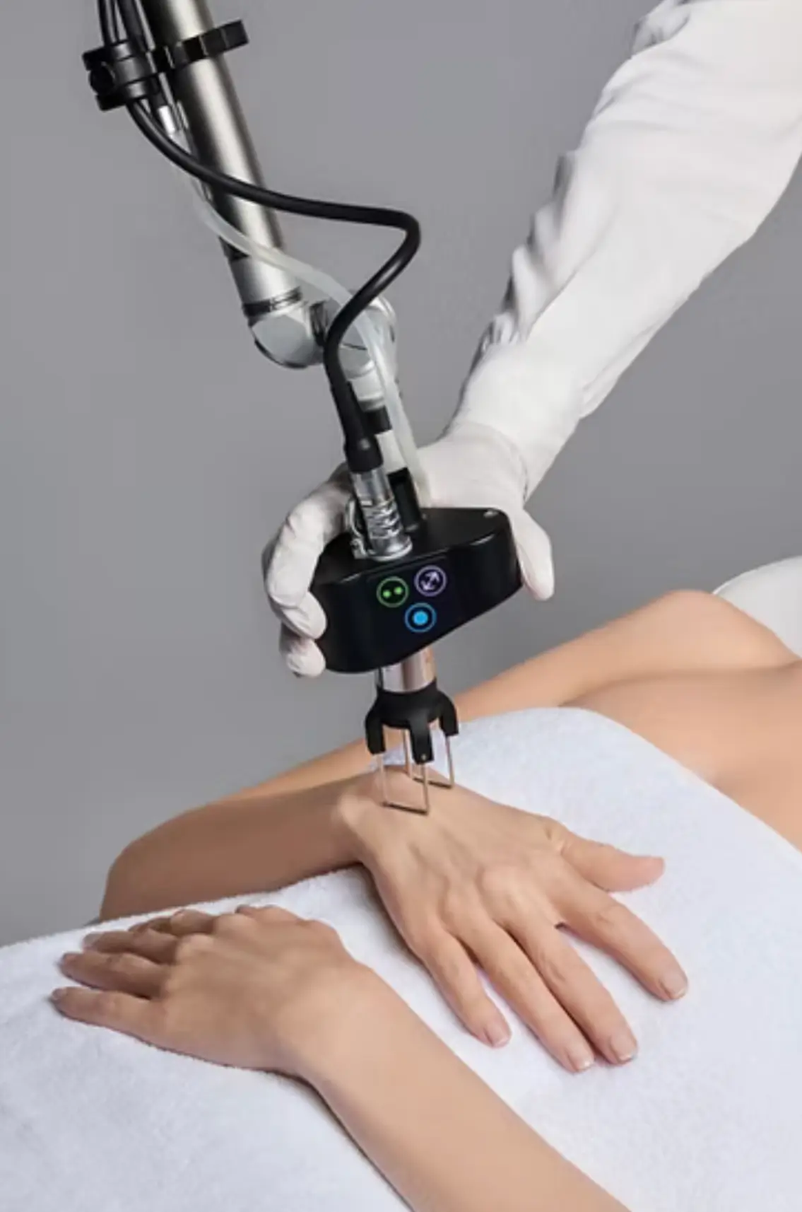 CO2 Tetra Coolpeel in Tampa, FL | Kiyani Aesthetics