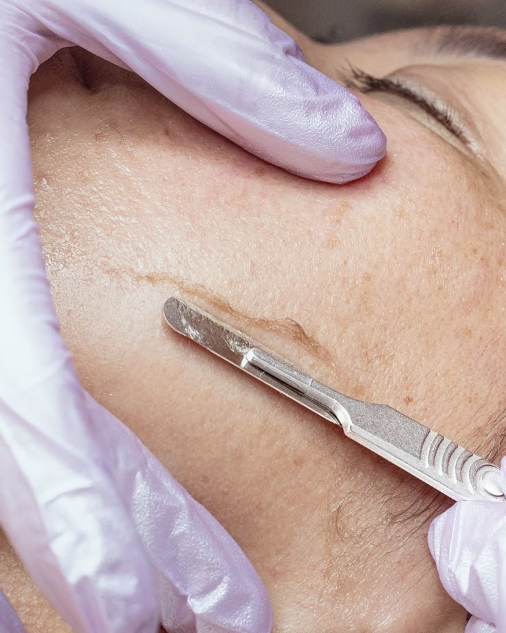 Dermaplaning Facial Kiyani Aesthetics in Tampa, FL