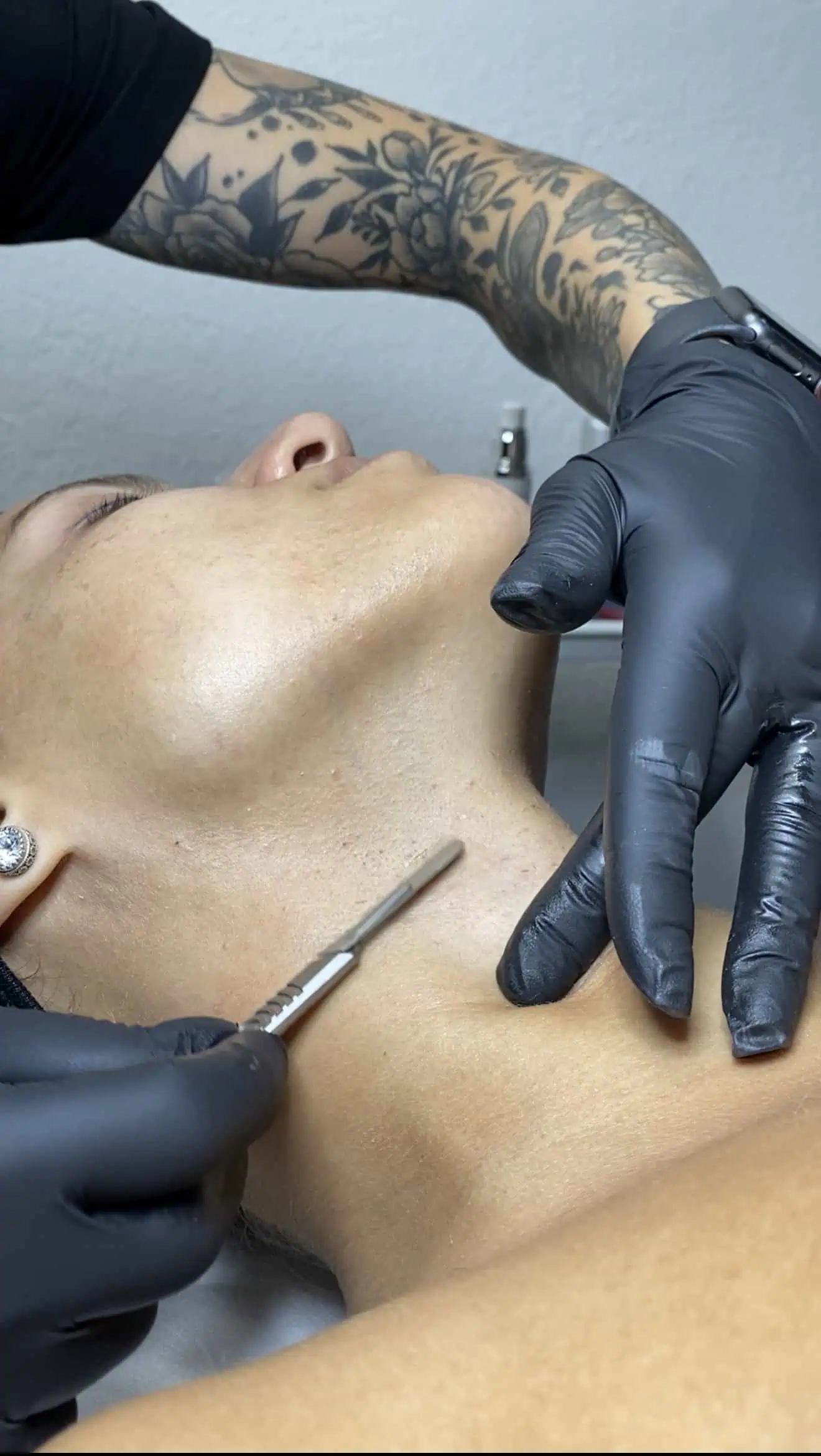Dermaplaning Facial in Tampa, FL by Kiyani Aesthetics